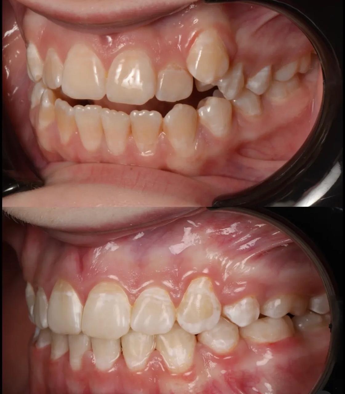 Antes e Depois 3